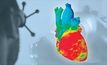 The Simulia Living Heart Project The Simulia Living Heart Project